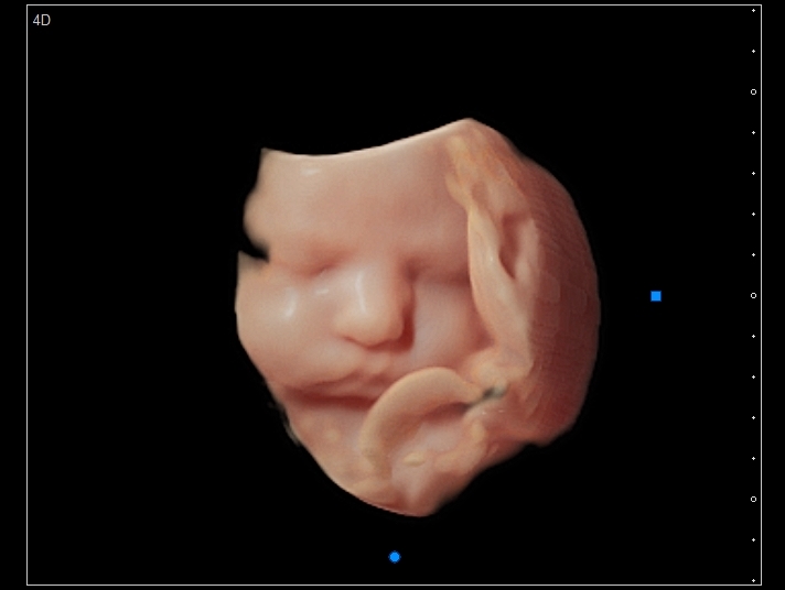 BUNDLE OF JOY 3D-4D MOBILE ULTRASOUND 's image