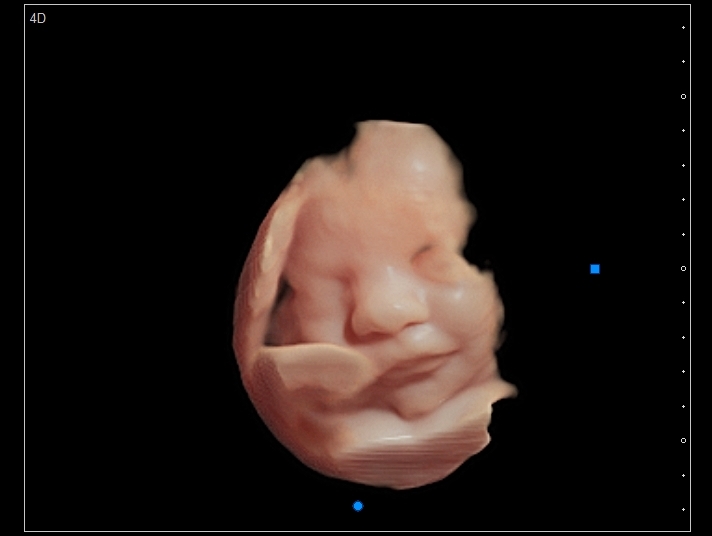BUNDLE OF JOY 3D-4D MOBILE ULTRASOUND 's image
