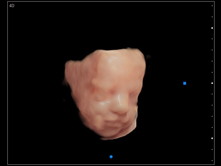BUNDLE OF JOY 3D-4D MOBILE ULTRASOUND 's image