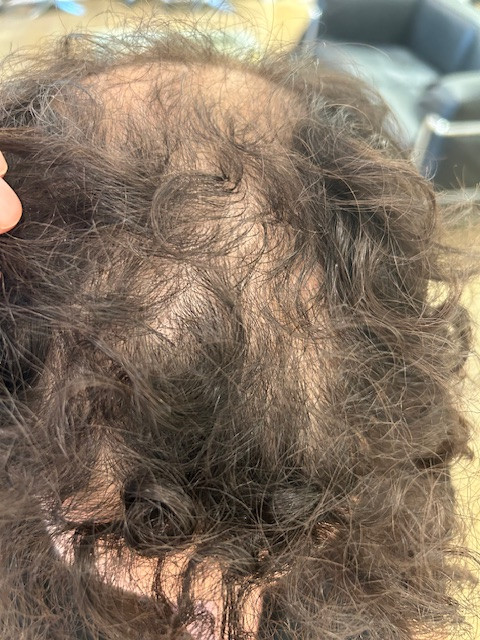 Regenerativ behandling's image