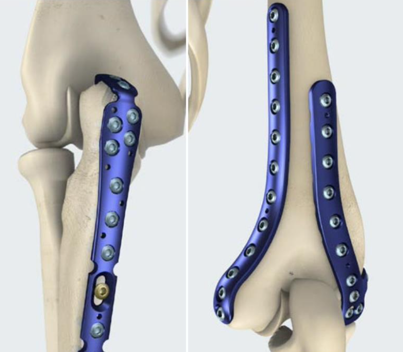 Elbow Plate
