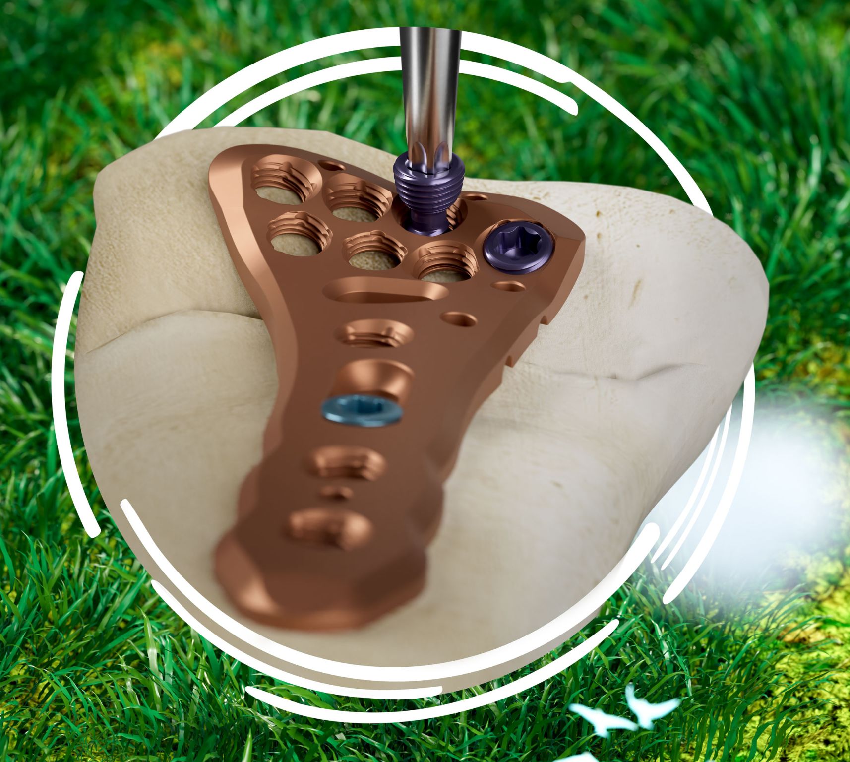 Medical Implants Namibia - Willem Smit's image