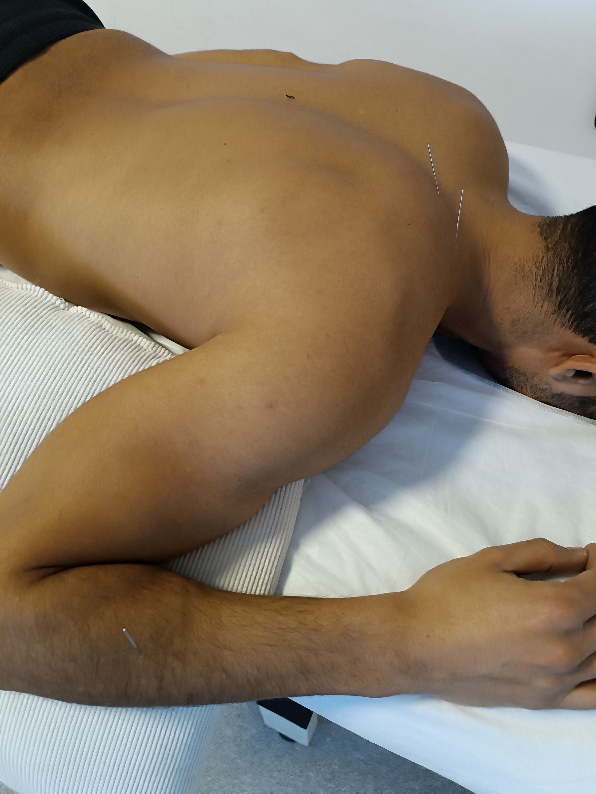 דיקור יבש, אורתופדי לכאב, חיפה