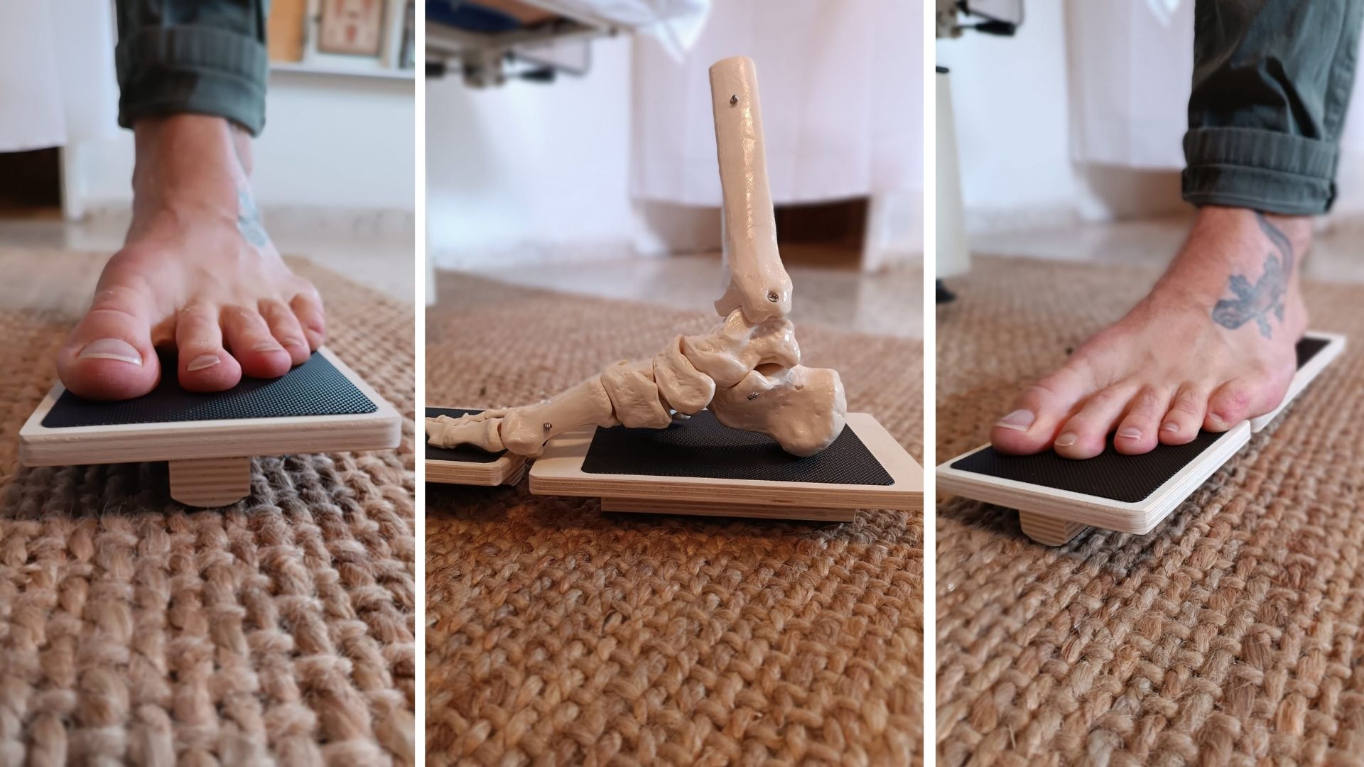 דורבן, פלטפוס, כאבי הליכה