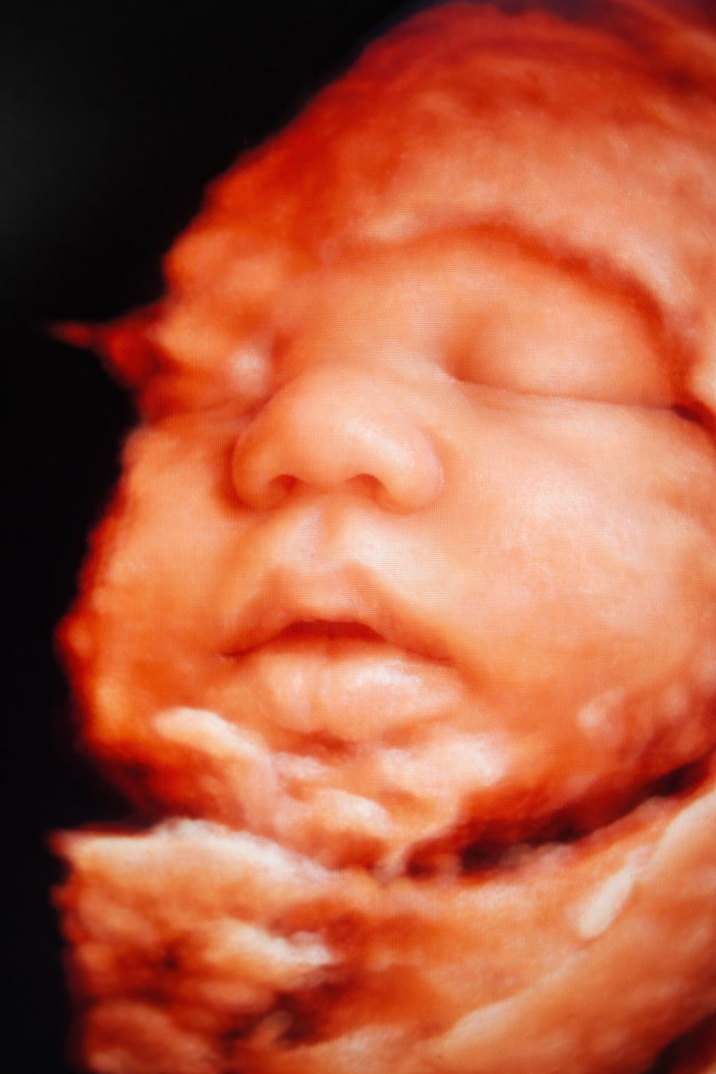 Baby Connection's Ultrasound 's image