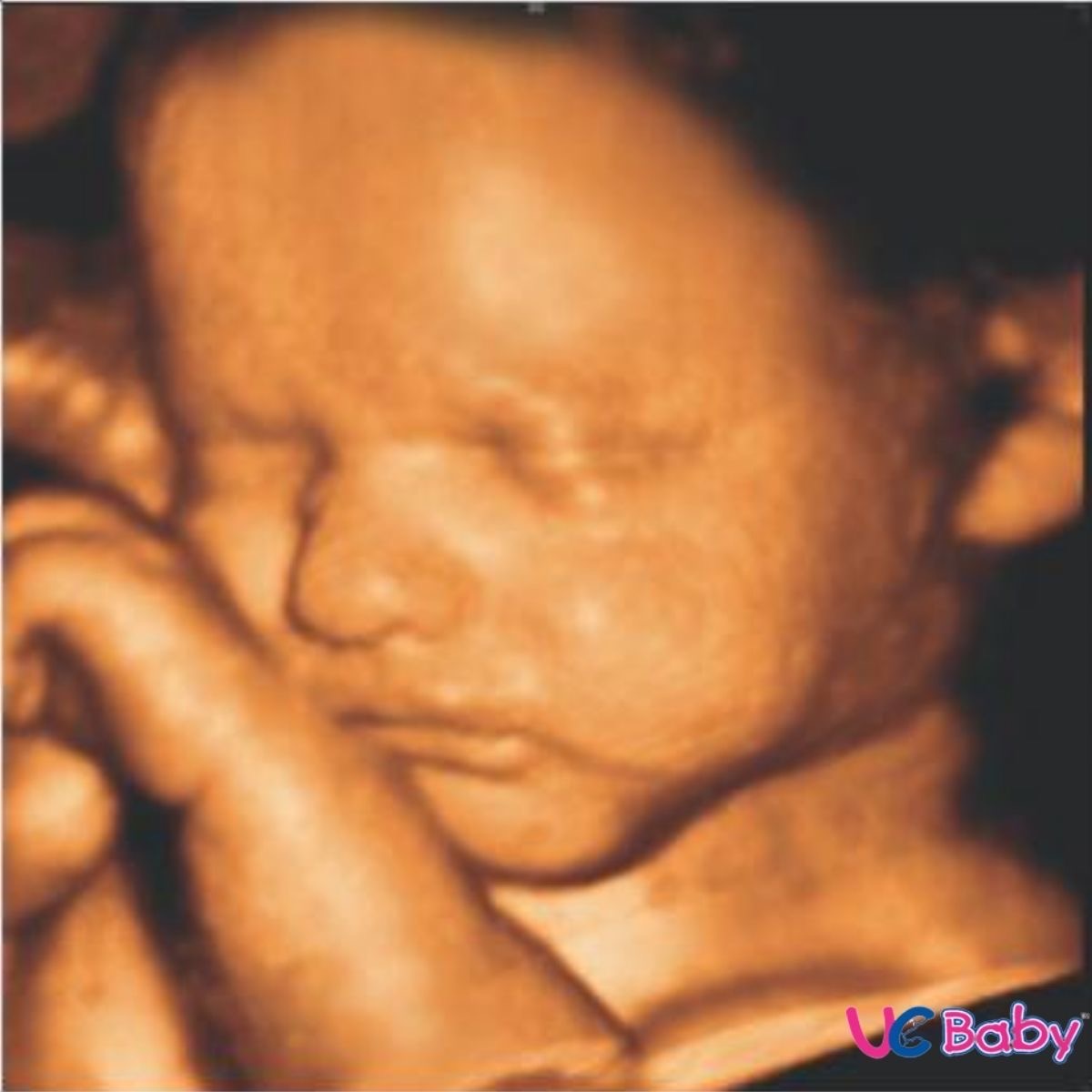 Baby Connection's Ultrasound 's image