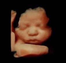 Baby Connection's Ultrasound 's image