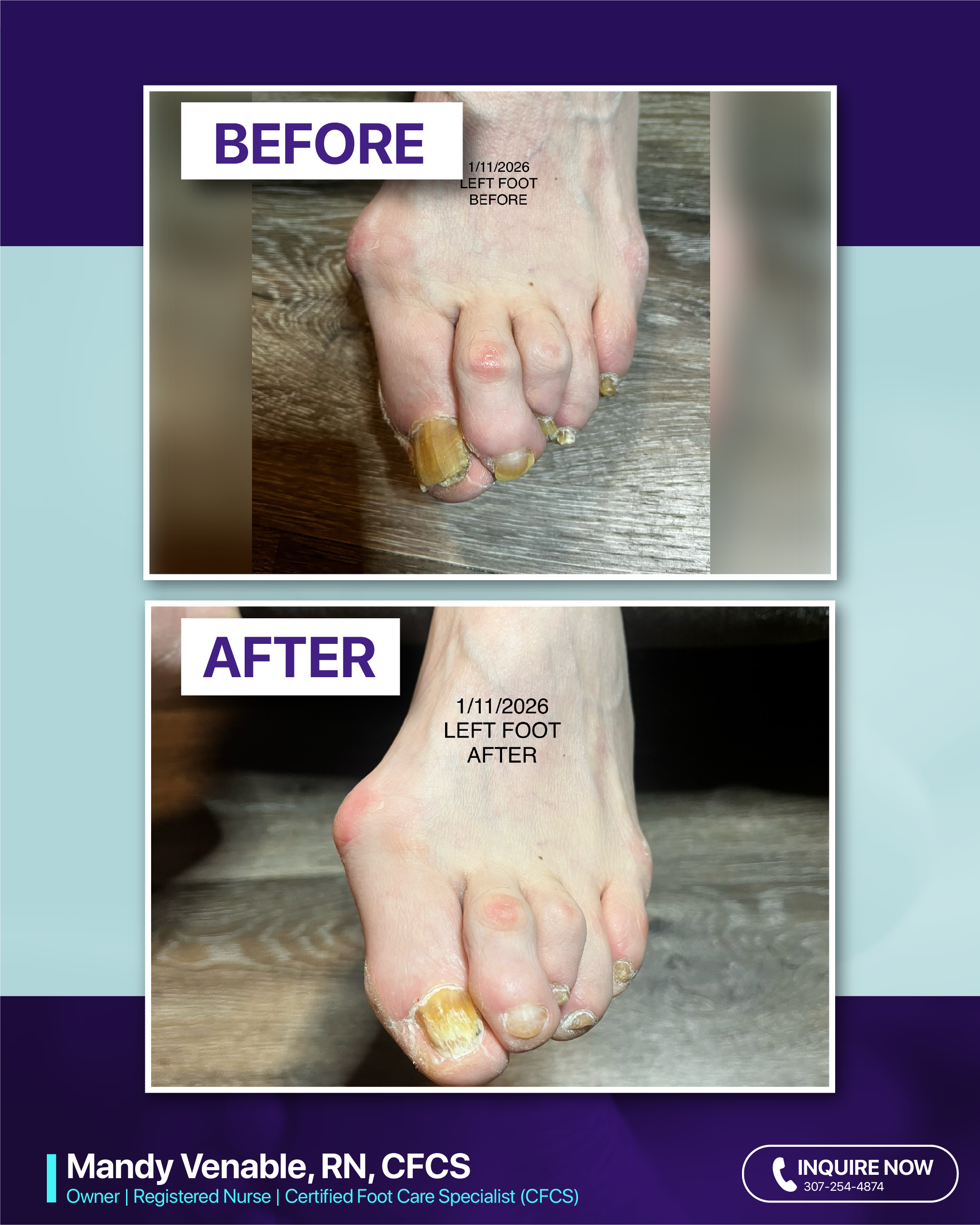 Mandy Venable RN, CFCS's image