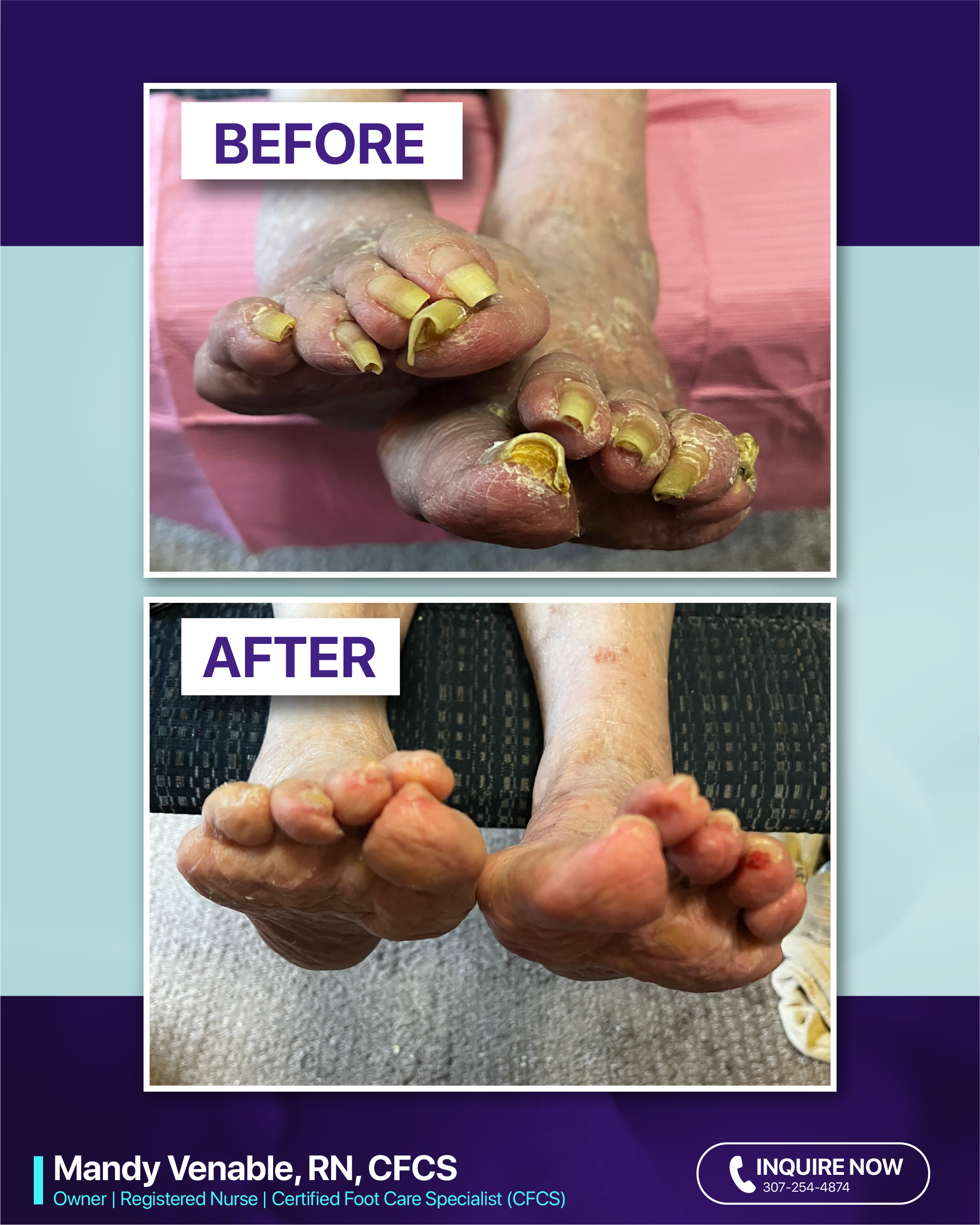 Mandy Venable RN, CFCS's image