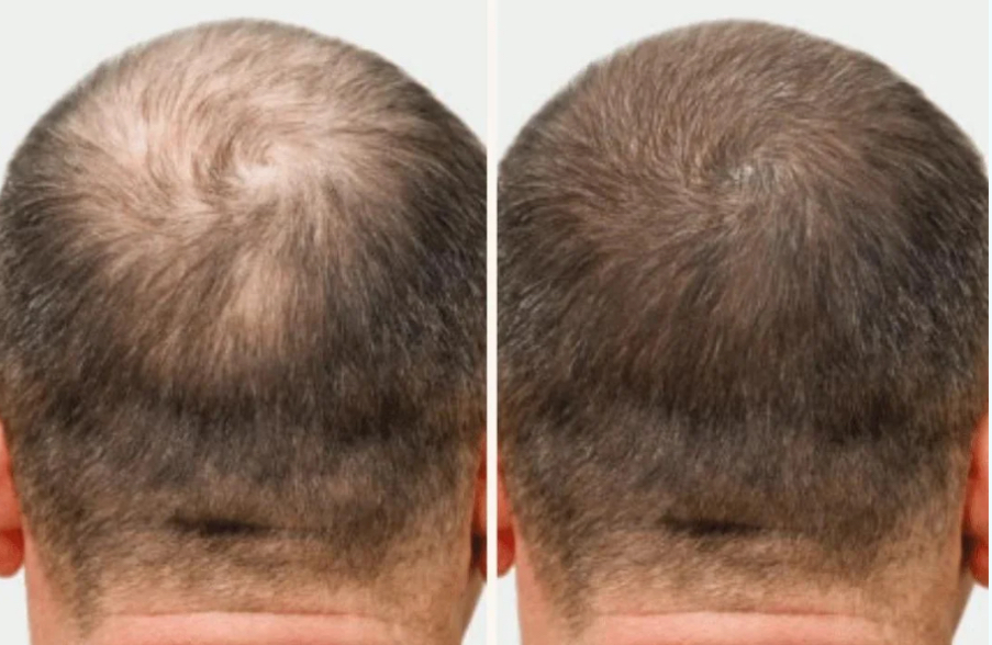 REJUVENATED ROOTS HEAD SPA's image