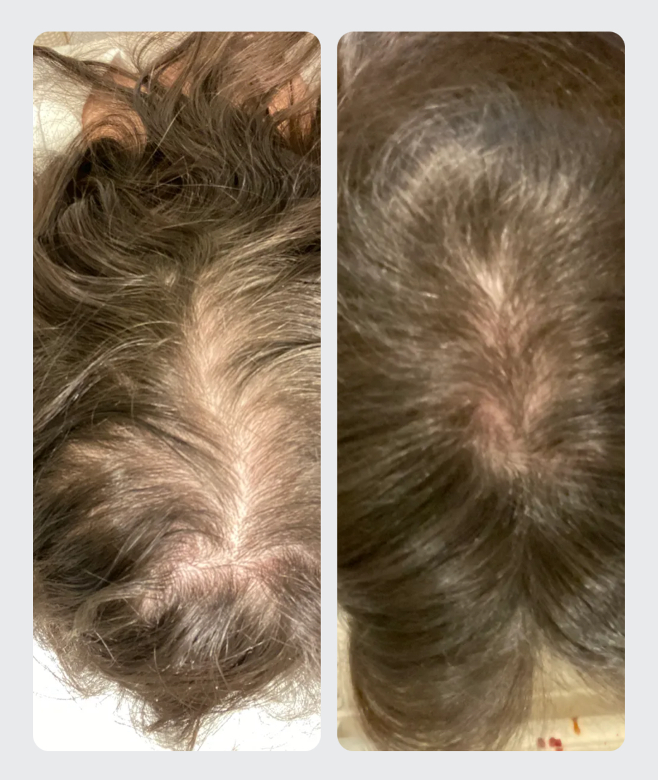REJUVENATED ROOTS HEAD SPA's image