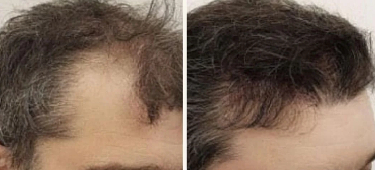 REJUVENATED ROOTS HEAD SPA's image