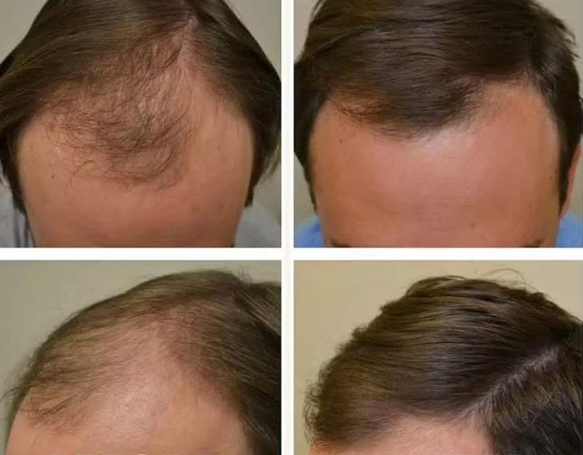 REJUVENATED ROOTS HEAD SPA's image