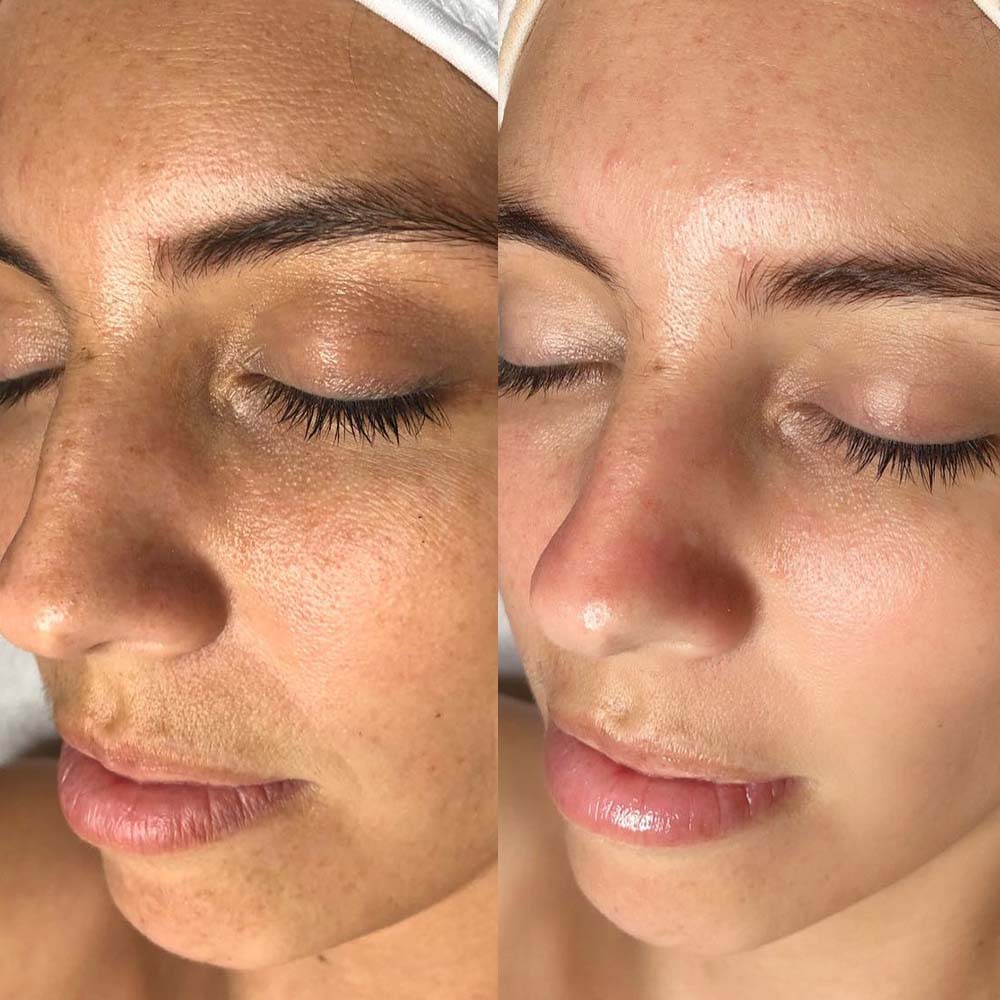 REJUVENATED ROOTS HEAD SPA's image