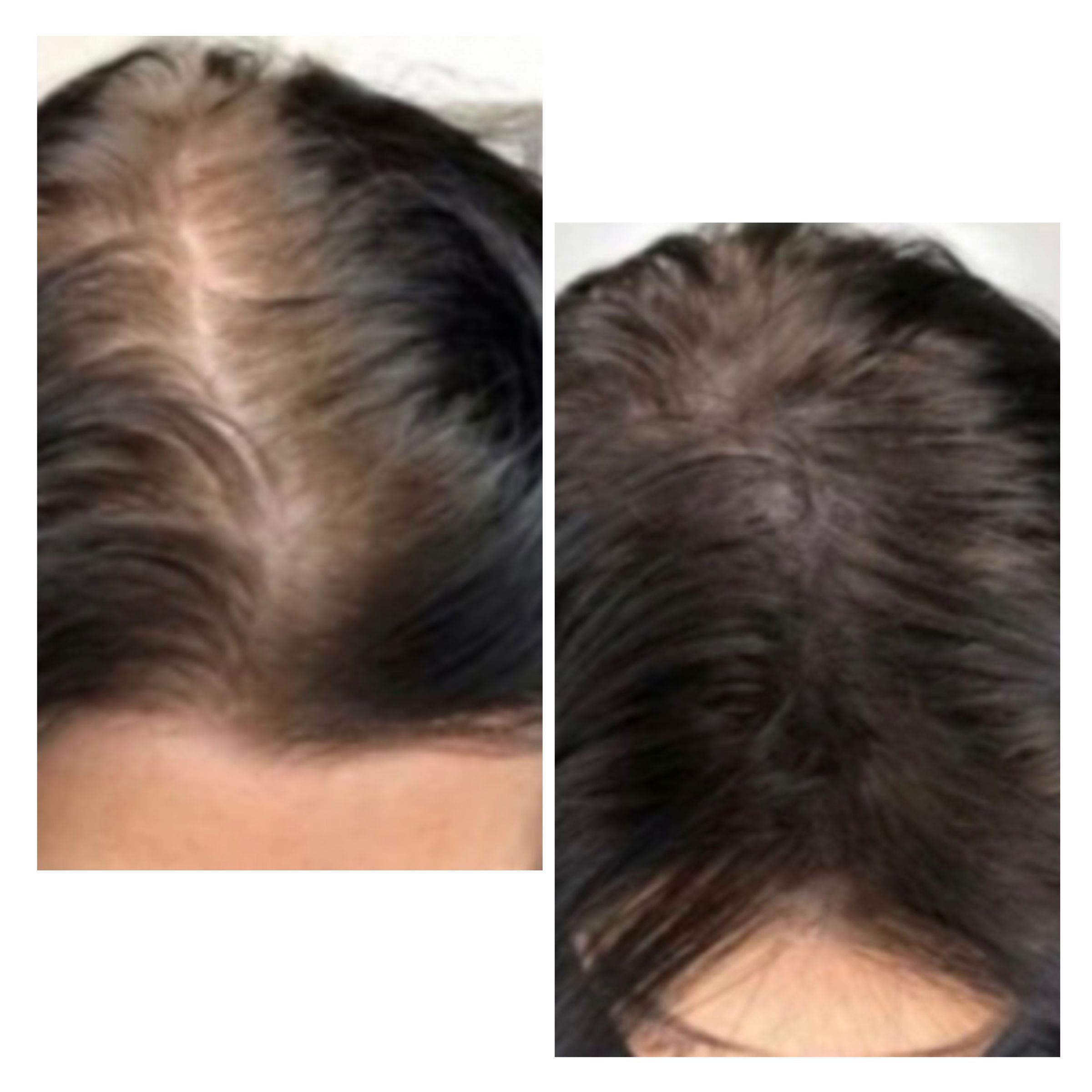 REJUVENATED ROOTS HEAD SPA's image