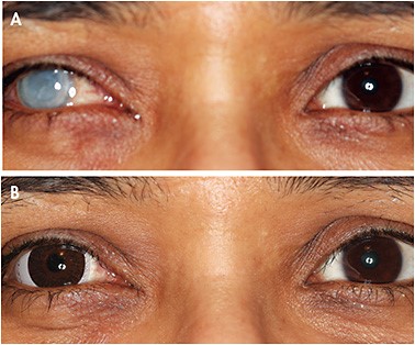 Visionbay specialist eye care's image