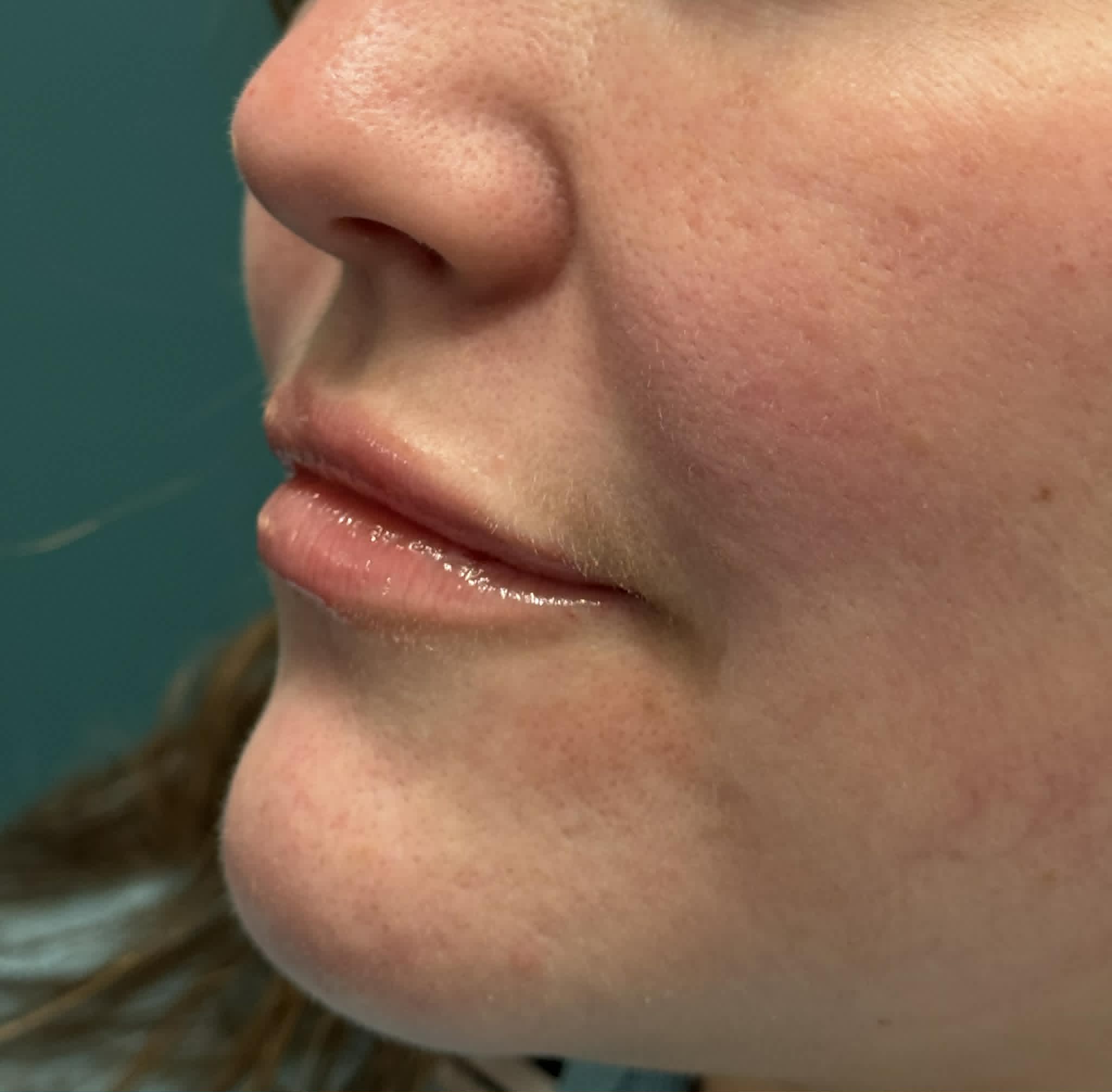 Josie - Lip Filler, BOTOX Treatment avatar