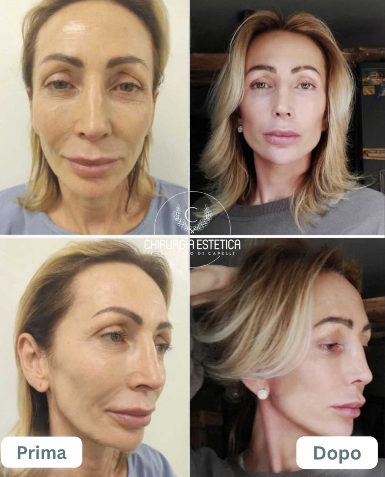 Chirurgia Estetica & Trapianto di Capelli's image