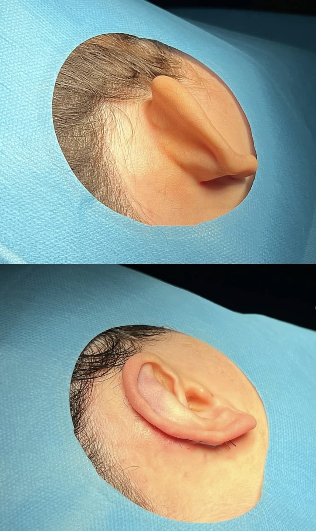Chirurgia Estetica & Trapianto di Capelli's image