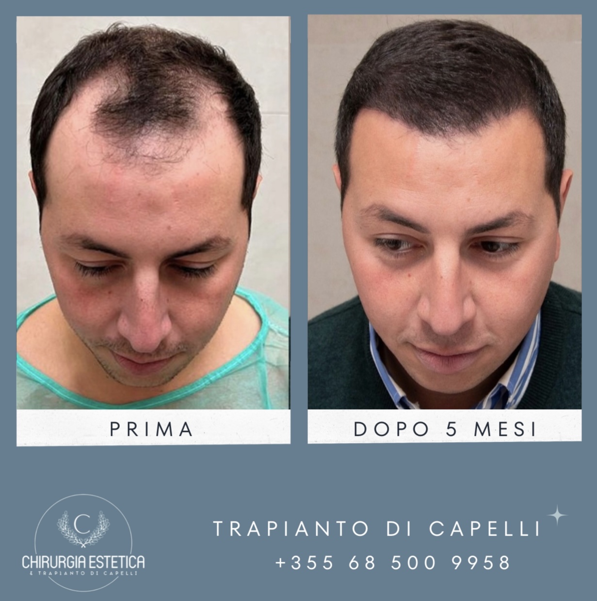 Chirurgia Estetica & Trapianto di Capelli's image