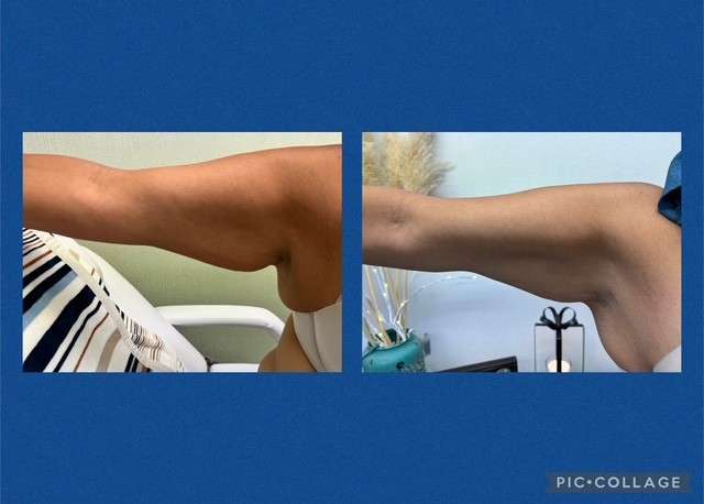 B Frosted American Cryo's image