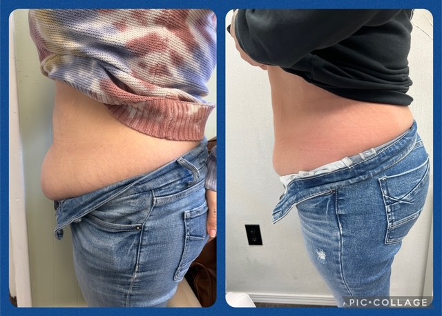 B Frosted American Cryo's image