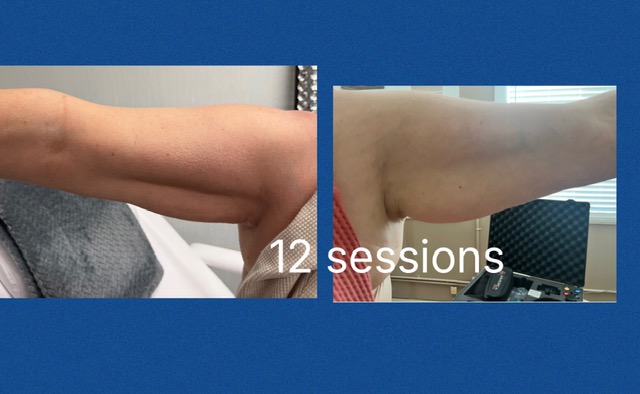 B Frosted American Cryo's image