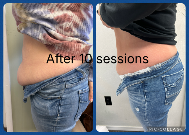 B Frosted American Cryo's image