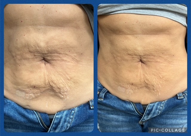 B Frosted American Cryo's image