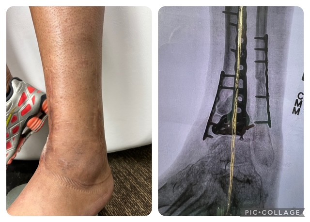 B Frosted American Cryo's image