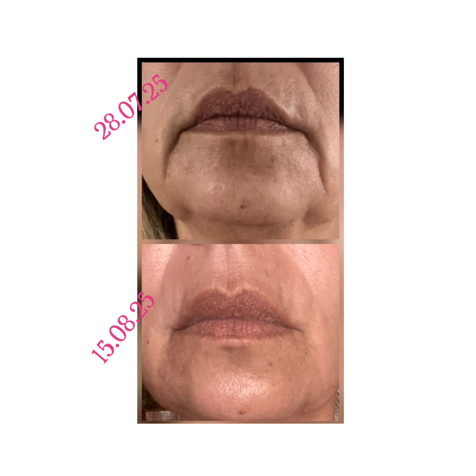 Kosmetik, NEM´s's image