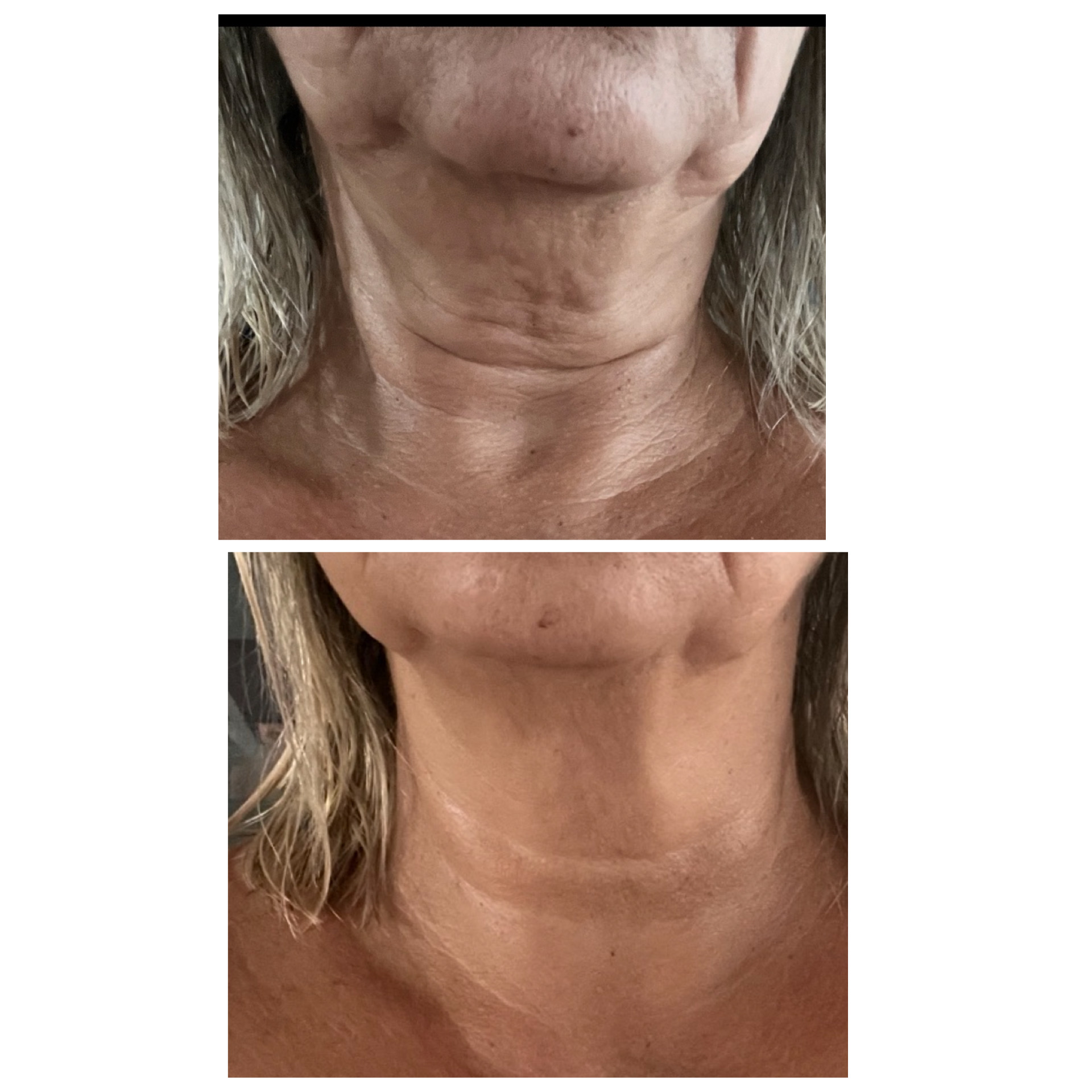 Kosmetik, NEM´s's image