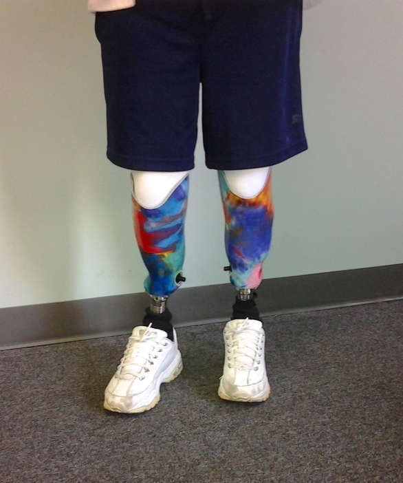 Nunnery Orthotic & Prosthetic Technologies's image