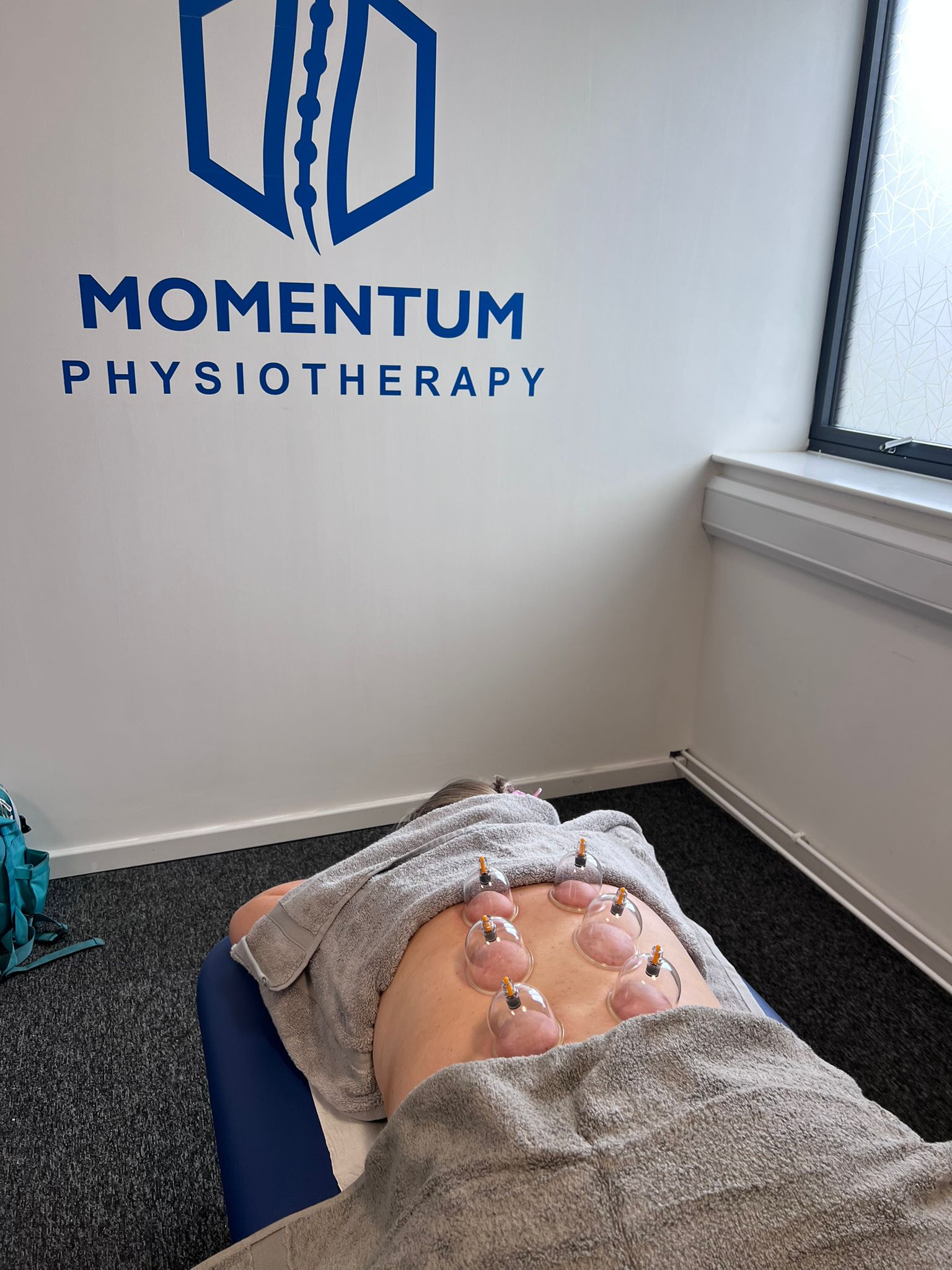 Cupping Session for backs