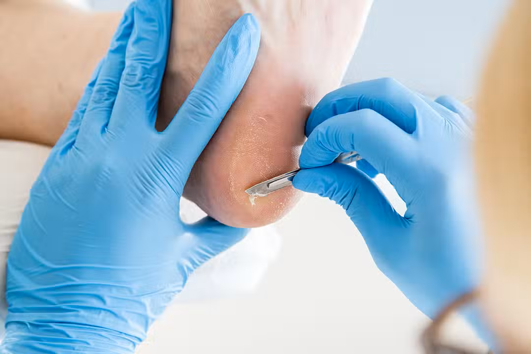 THE FOOT NURSES's image