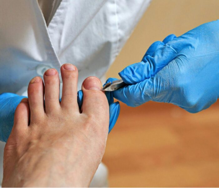 THE FOOT NURSES's image