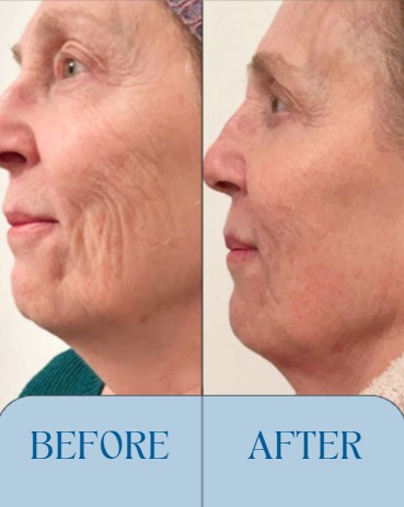 KC Cryo in triad NC 's image