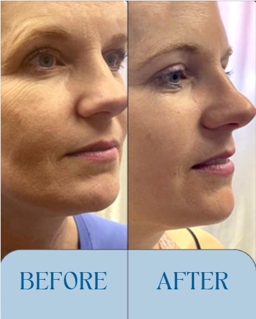 KC Cryo in triad NC 's image