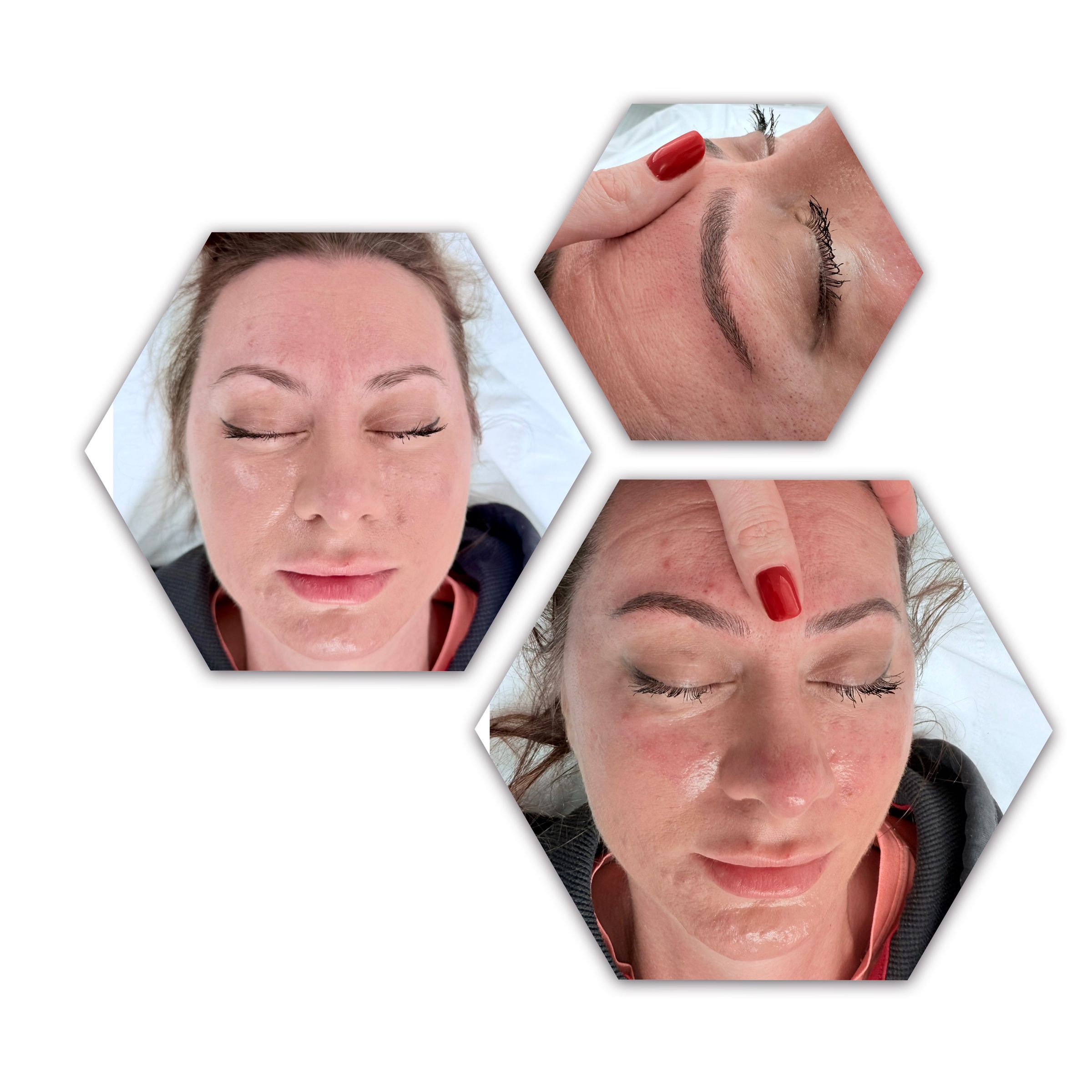 Semi-Permanent Makeup & Laser in Worcester | Beauty Poem's image