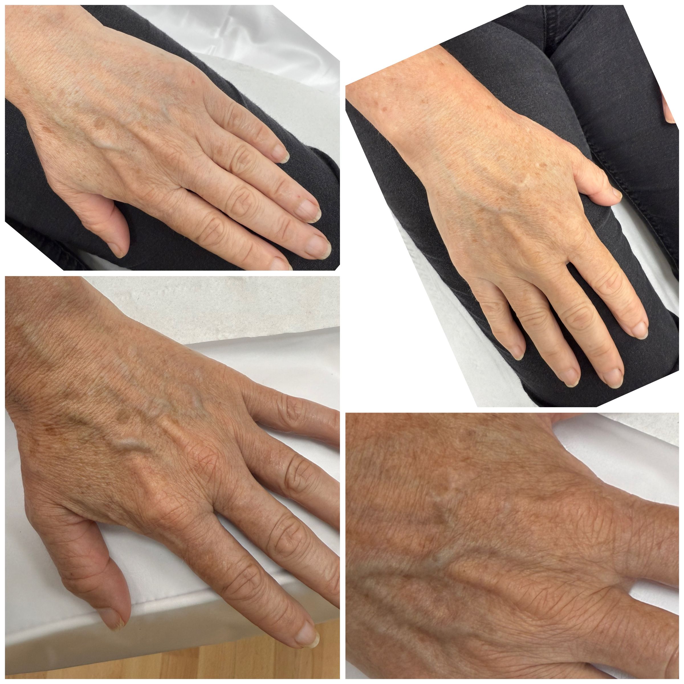 Semi-Permanent Makeup & Laser in Worcester | Beauty Poem's image
