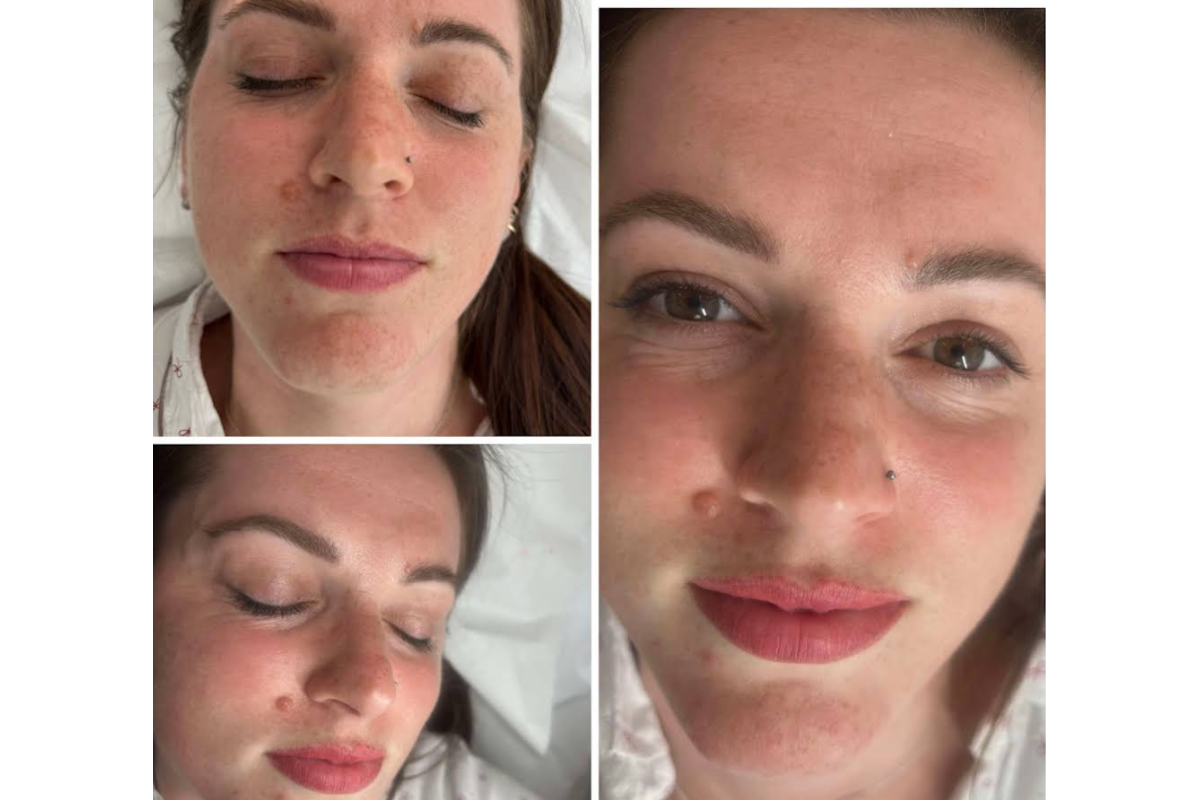 Semi-Permanent Makeup & Laser in Worcester | Beauty Poem's image