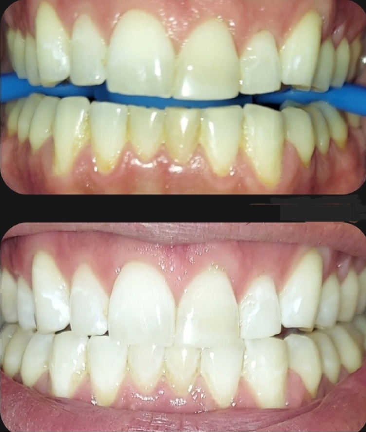 WHITENING EXPRESS's image
