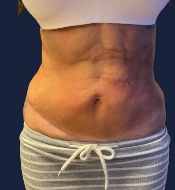 Trinity Lymphatics 's image