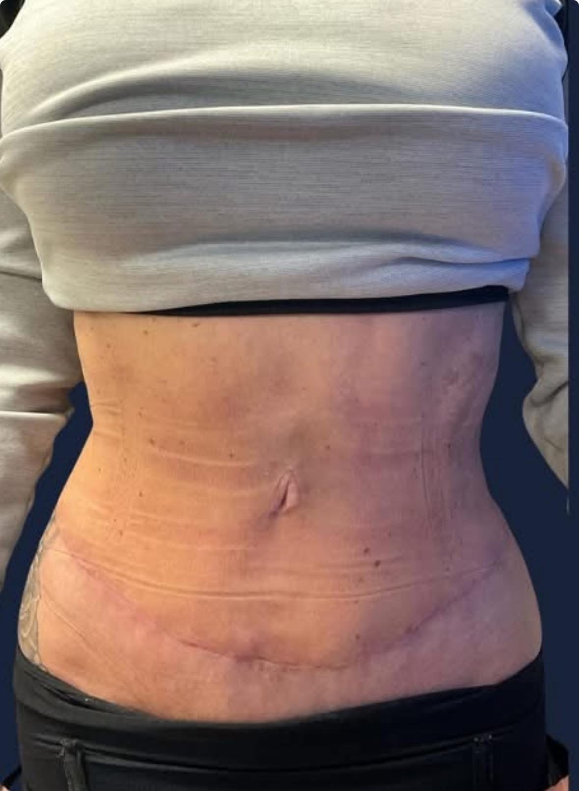 Trinity Lymphatics 's image