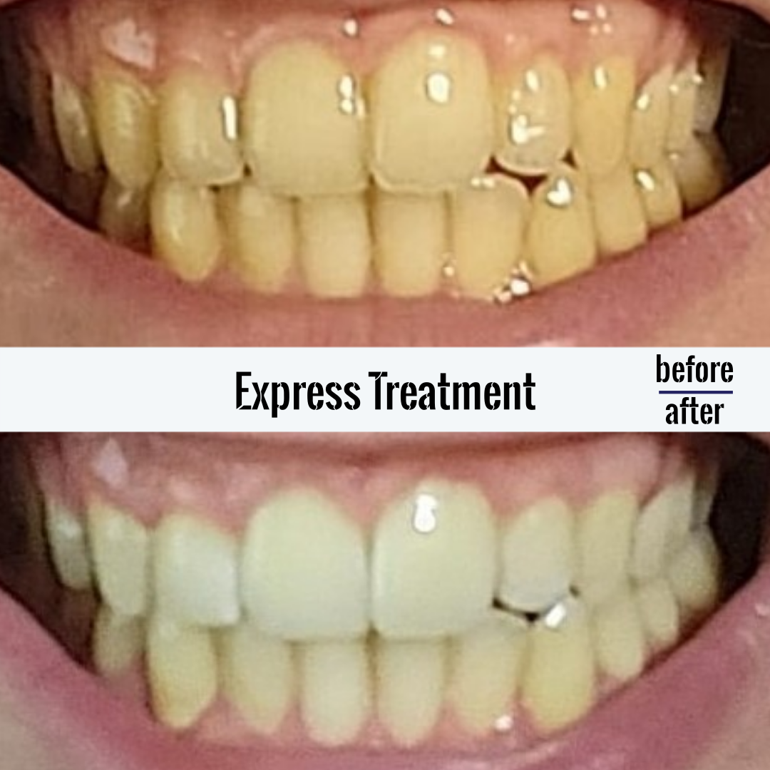 Amara Body & Soul |Teeth Whitening, Massage, Quit Smoking's image