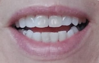 Amara Body & Soul |Teeth Whitening, Massage, Quit Smoking's image