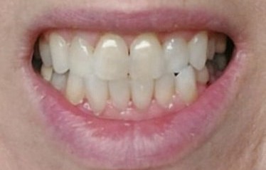 Amara Body & Soul |Teeth Whitening, Massage, Quit Smoking's image