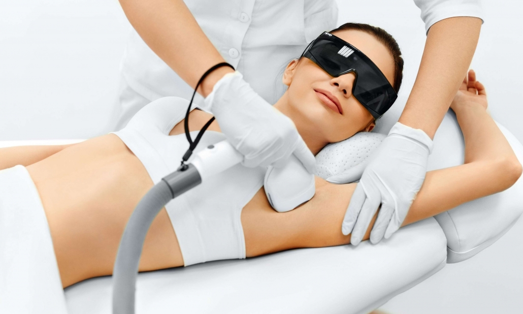 Laser Epilation