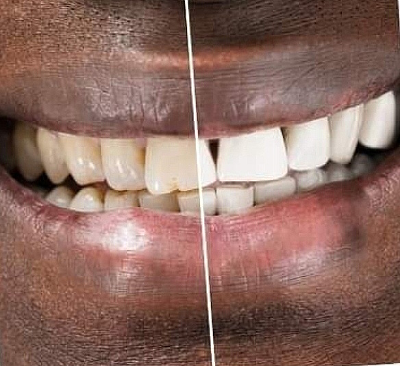 Pure Bliss Spa & wellness 's image