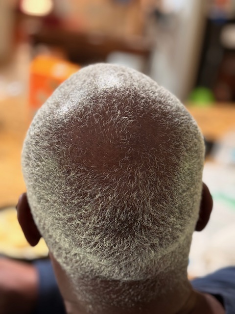 8 days of using Root Chakya & 1st DOS